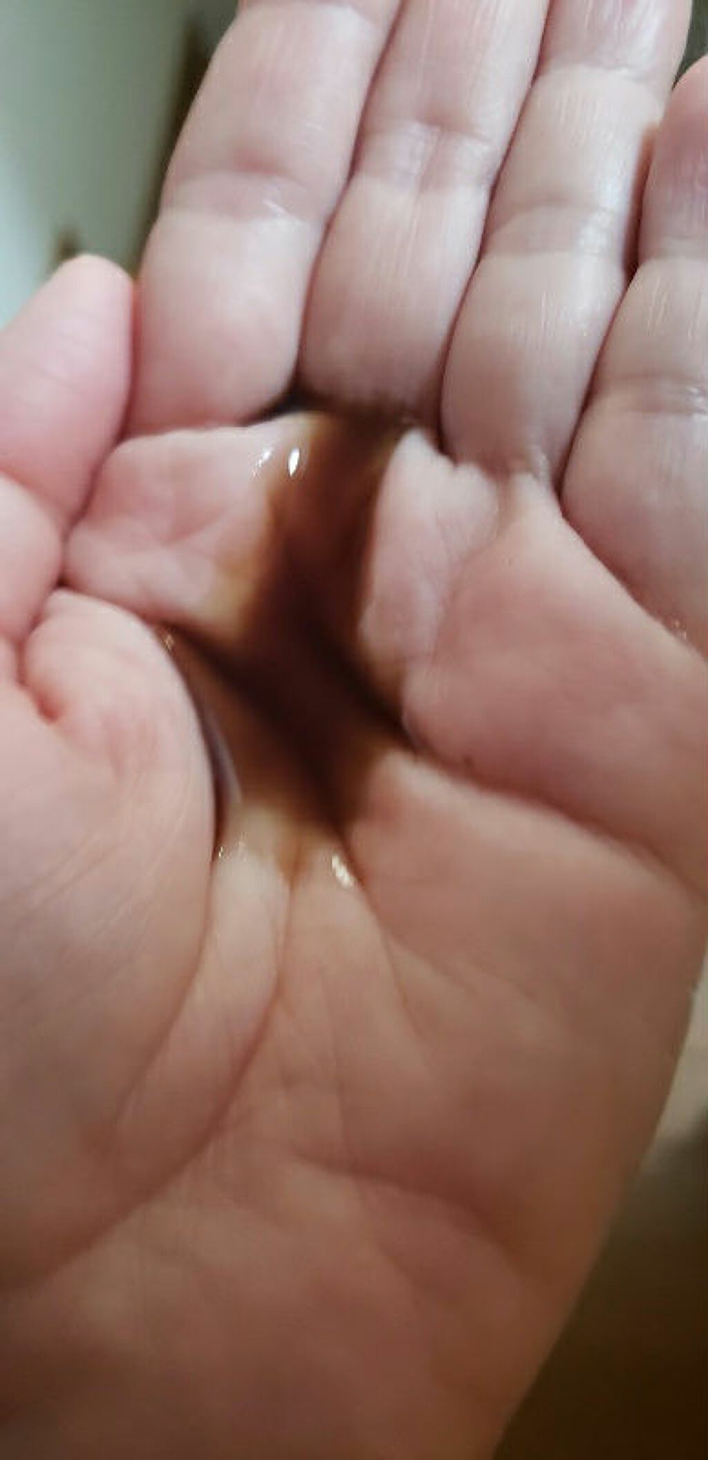 プロヘマチン原液/fracora/洗い流すヘアトリートメントを使ったクチコミ(2枚目)