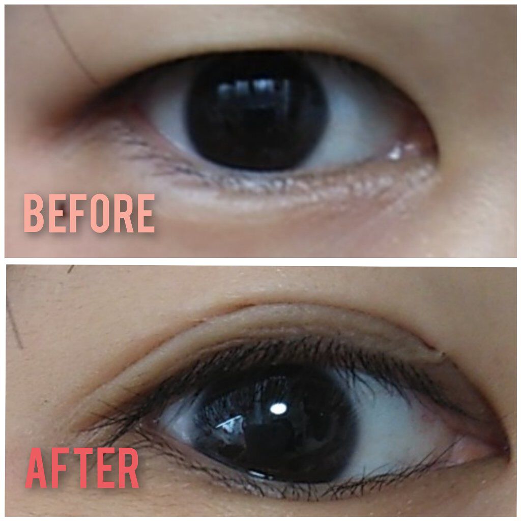 フリーファイバー120 スタンダードタイプ /メザイク/二重まぶた用アイテムを使ったクチコミ（2枚目）