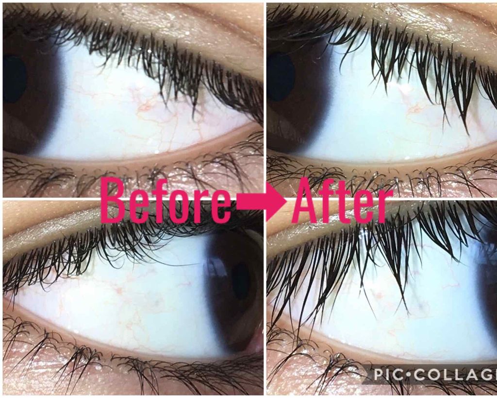 スマイルホワイティエ(医薬品)/ライオン/その他を使ったクチコミ（3枚目）