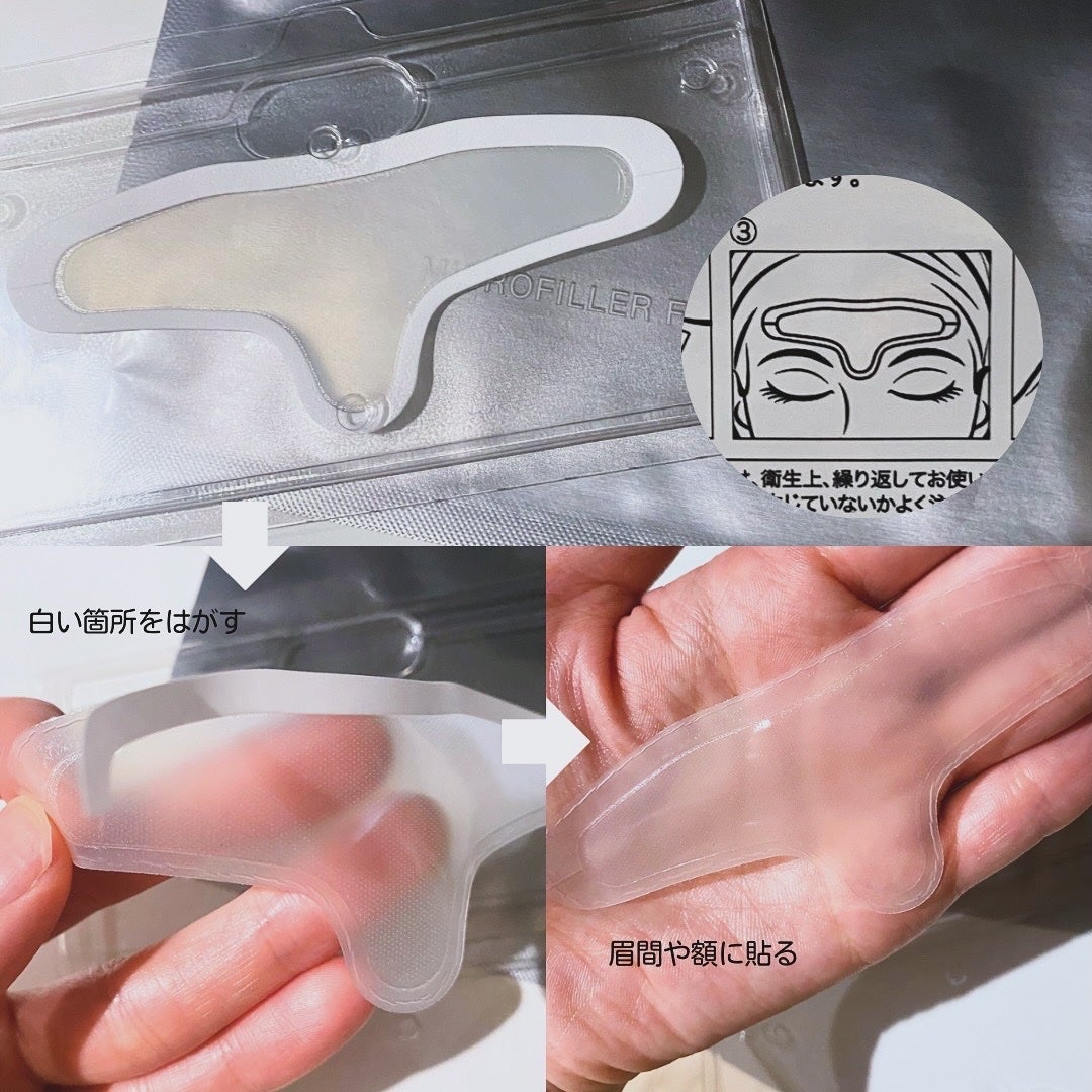 メディリフト マイクロフィラー フォアヘッド/YA-MAN TOKYO JAPAN/頭皮ケアを使ったクチコミ(5枚目)