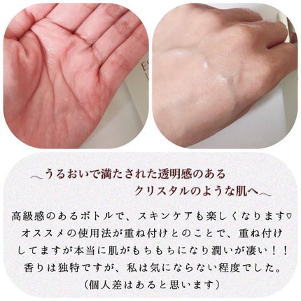 マイクロ エッセンス ローション BF/ESTEE LAUDER/化粧水を使ったクチコミ(3枚目)