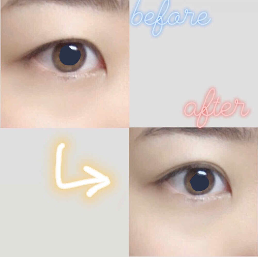 メザイク フリーファイバー120 スタンダードタイプ /メザイク/二重まぶた用アイテムを使ったクチコミ（2枚目）