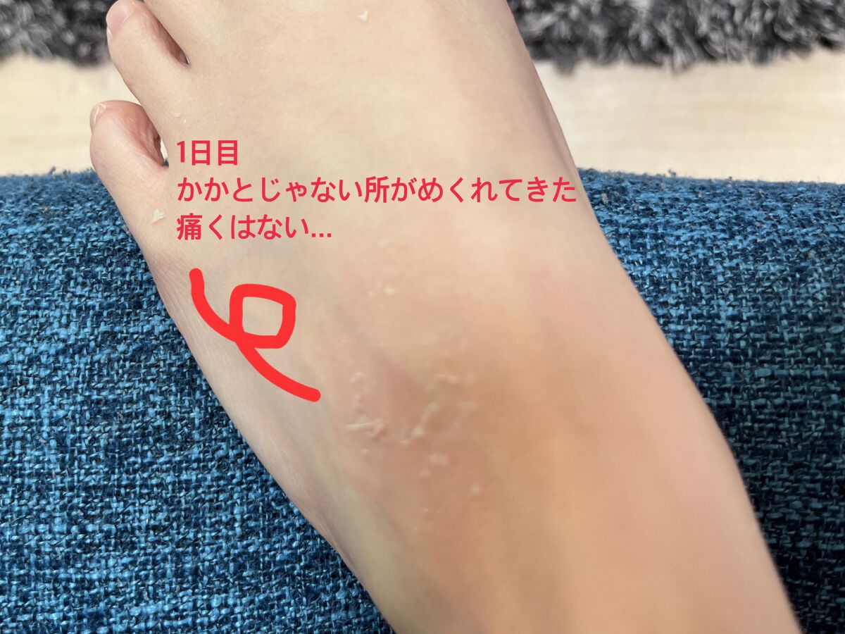 イージーパックDP60分タイプ/ベビーフット/レッグ・フットケアを使ったクチコミ(5枚目)