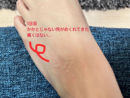 イージーパックDP60分タイプ/ベビーフット/レッグ・フットケアを使ったクチコミ(5枚目)