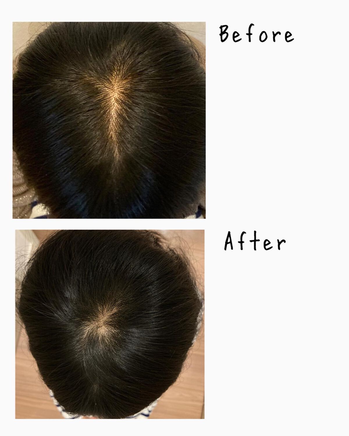 growbio/JYU-KEN/頭皮ローションを使ったクチコミ（3枚目）