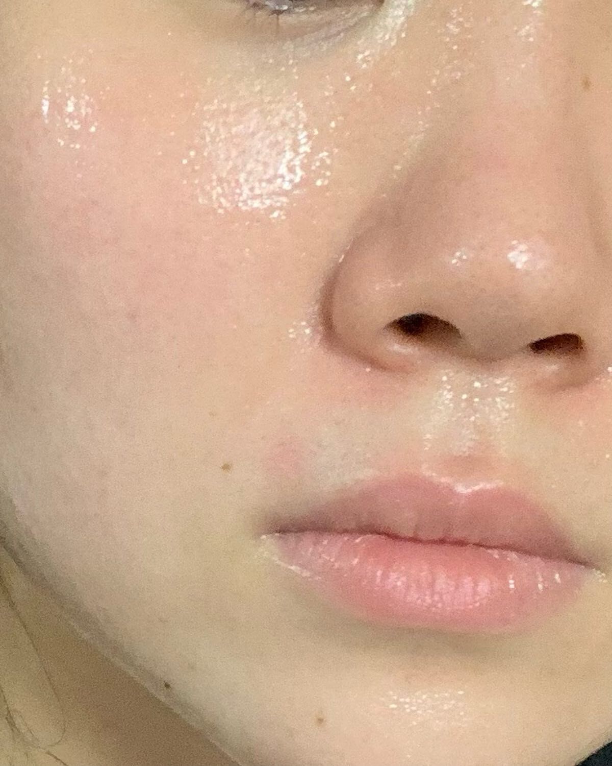 カロテンIPMP(TM) ブレミッシュカーミングセラムパッド/APRILSKIN/トナーパッドを使ったクチコミ(5枚目)