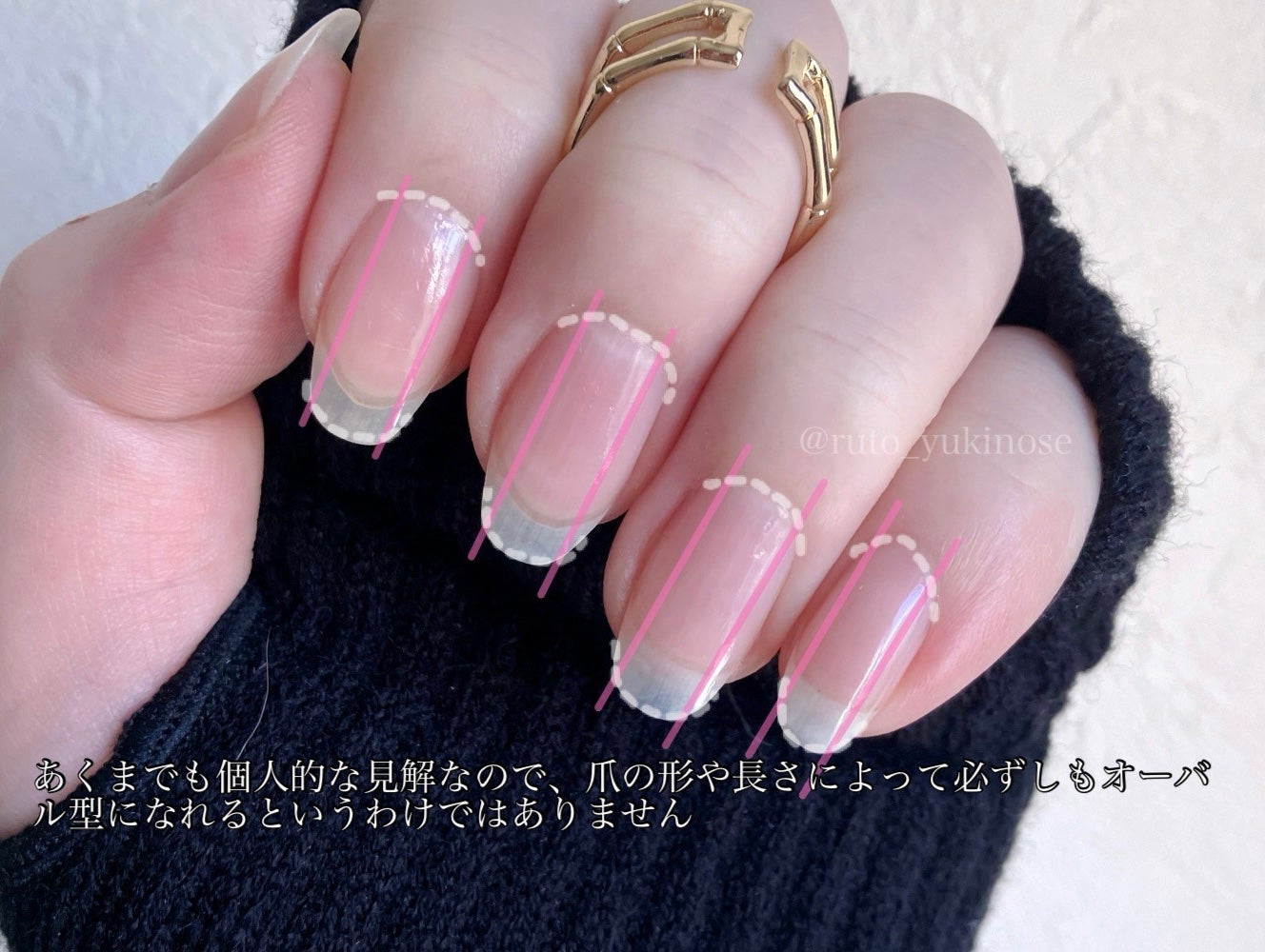 雪ノ瀬@ブルベ冬 on LIPS 「私的オーバル型爪の整え方✨✼••┈┈••✼••┈┈••✼••┈..」(4枚目)