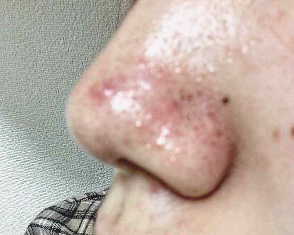 ホワイトケア トライアルセット/b.glen/スキンケアキットを使ったクチコミ(2枚目)