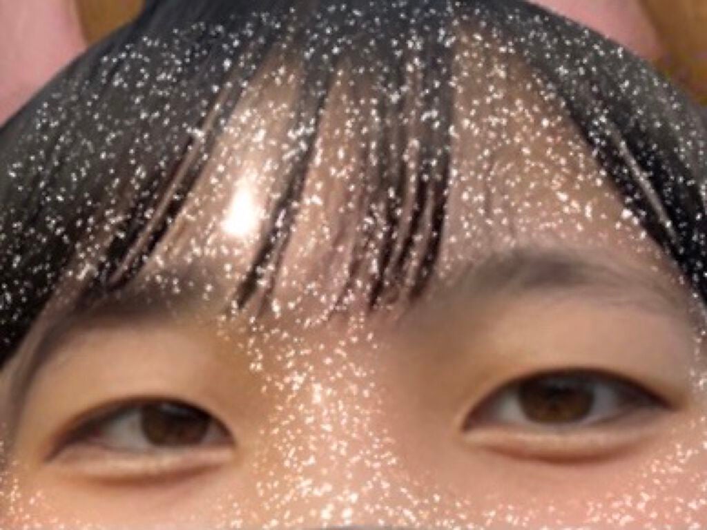 はみがきしすてま on LIPS 「遅れてごめんネ!埋没考えてる人にガチの埋没レポート埋没を3/1..」(2枚目)