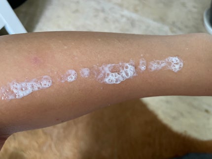 爽やかなUV泡ジェル /紫外線予報/日焼け止めジェルを使ったクチコミ(2枚目)