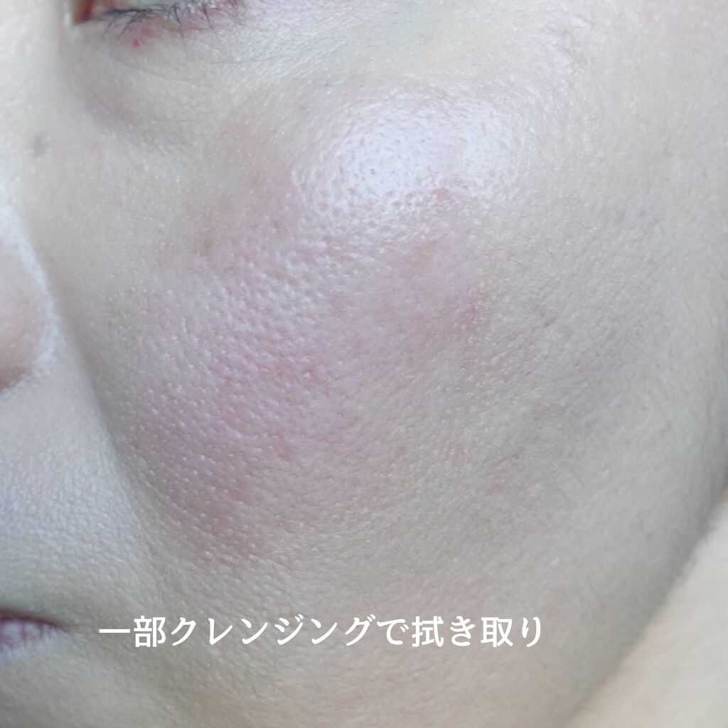 マイクロコレクトフィットクッション/moonshot/クッションファンデーションを使ったクチコミ(8枚目)