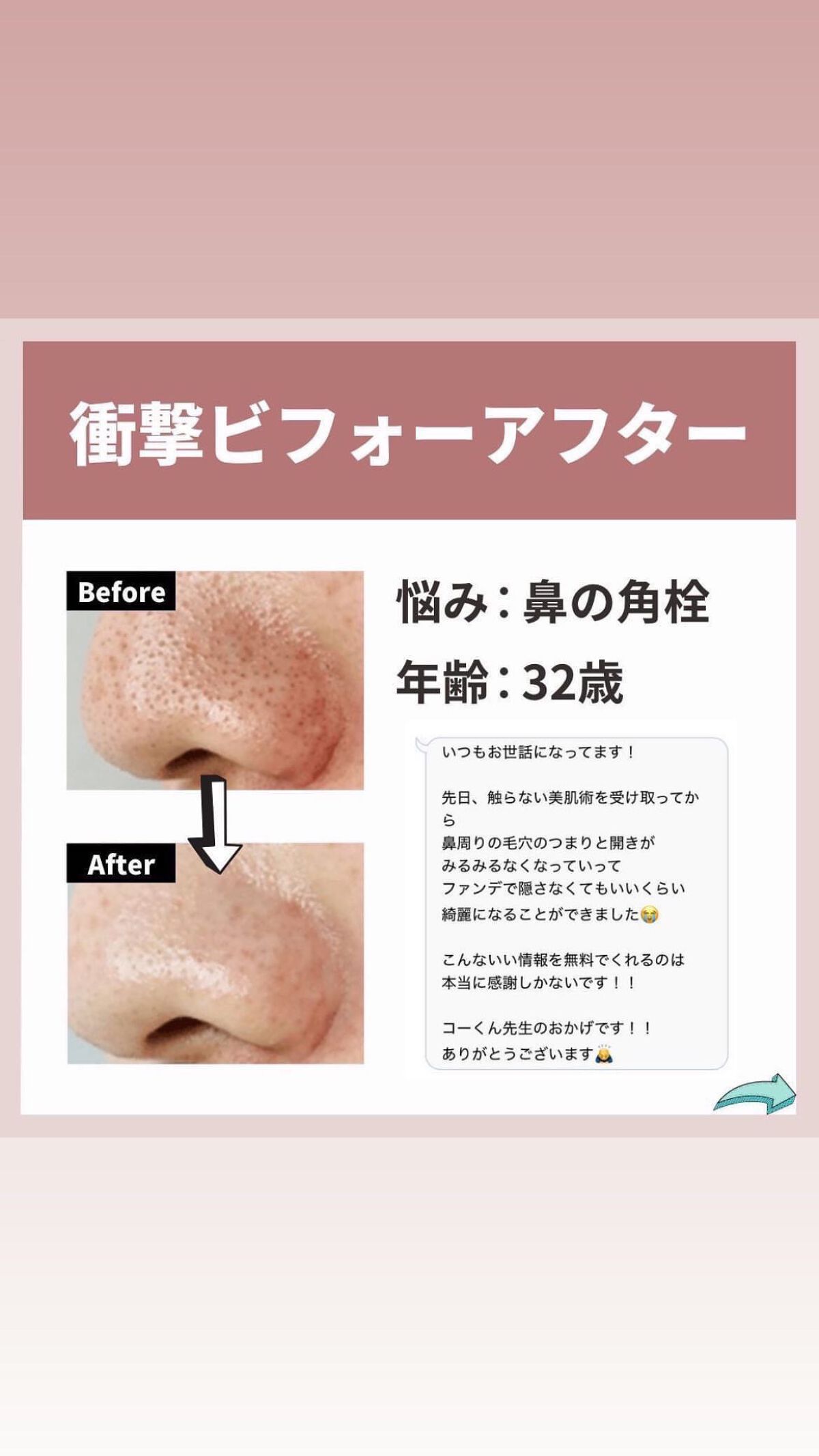 を使ったクチコミ（3枚目）