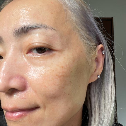 shirocara薬用ホワイトニングジェル/shirocara/オールインワン化粧品を使ったクチコミ(6枚目)