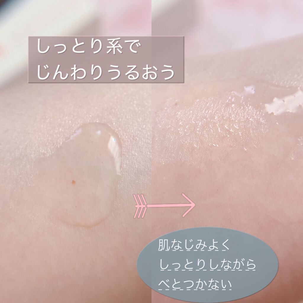 カレンデュラ手づみローション/ナチュラルアイランド/化粧水を使ったクチコミ（2枚目）