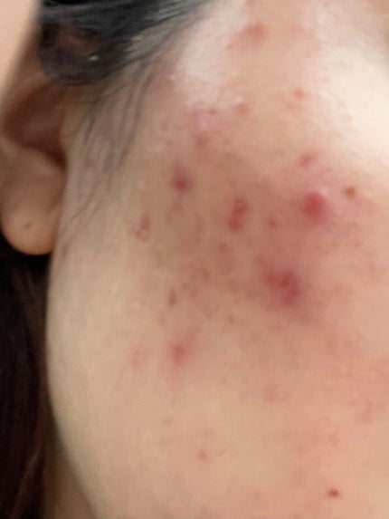 を使ったクチコミ(1枚目)