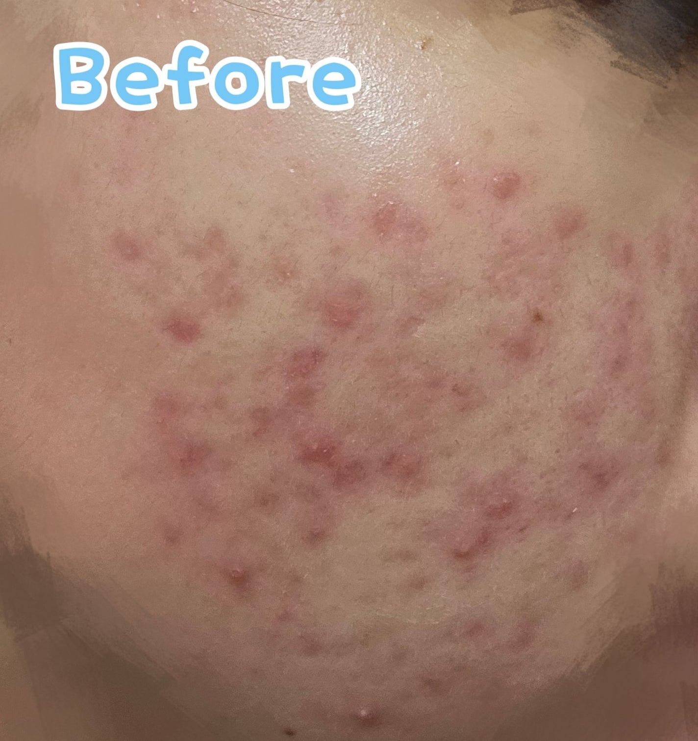 カプセルインハイドロクレンズ 医薬部外品/PLUEST/クレンジングジェルを使ったクチコミ(3枚目)