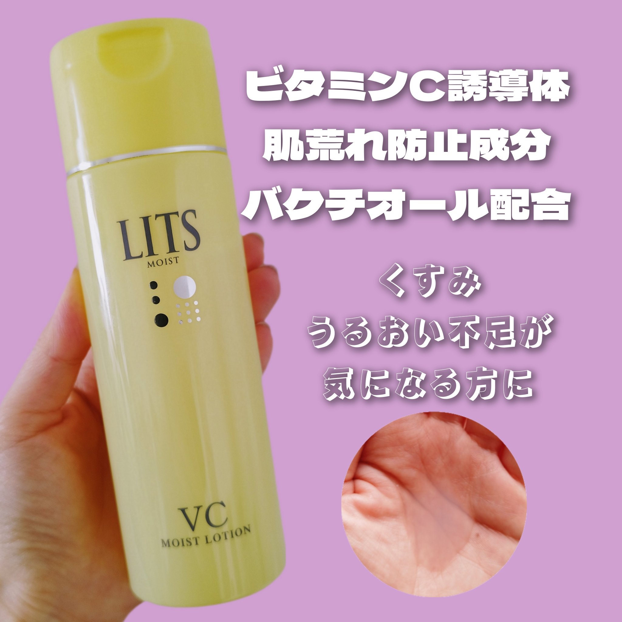 モイスト ローションC/リッツ/化粧水を使ったクチコミ（1枚目）