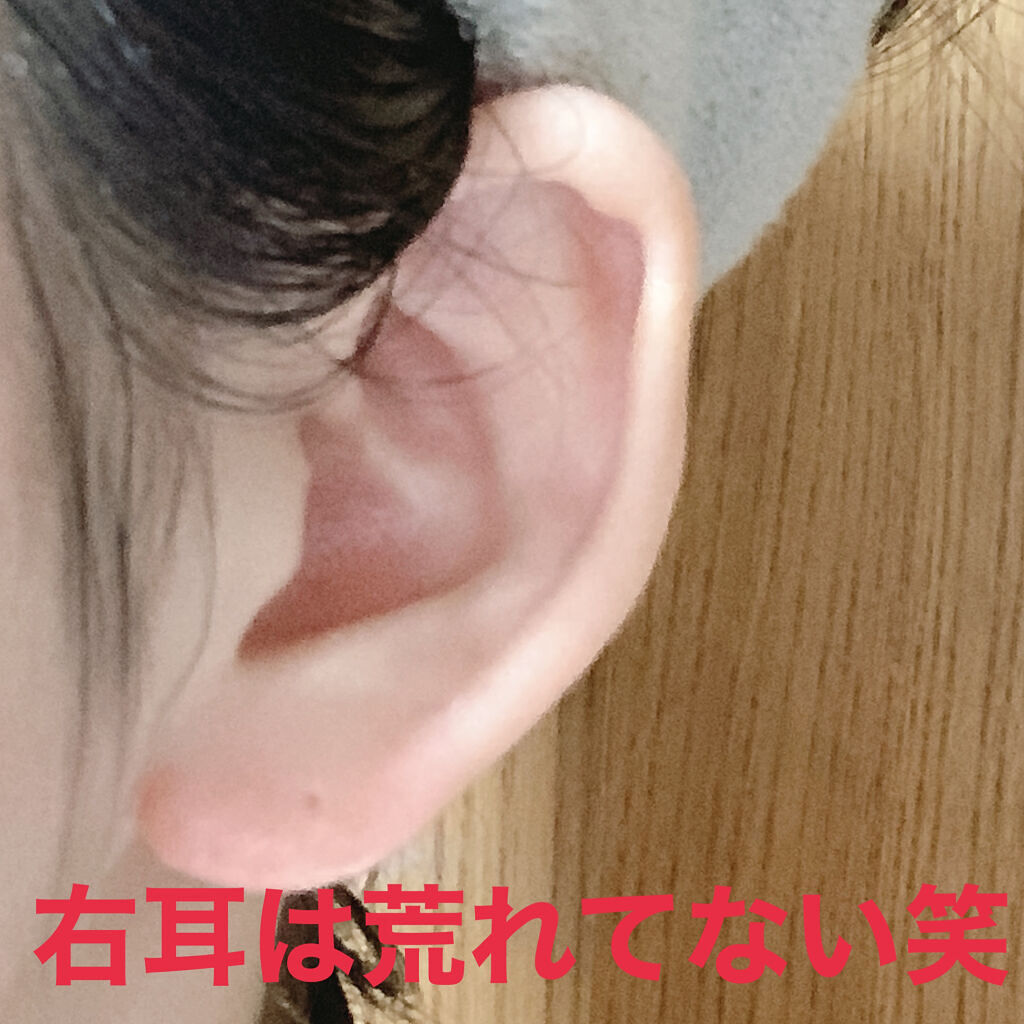 ミーミエイド(医薬品)/小林製薬/その他を使ったクチコミ（3枚目）