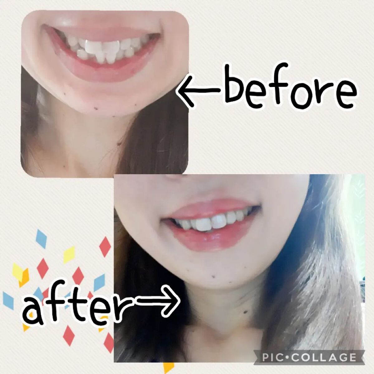 PTPハミガキ /プレビュート/歯磨き粉を使ったクチコミ（2枚目）