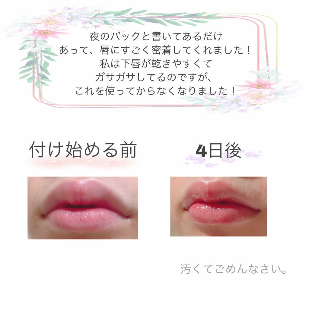 リップケア バーム/キュレル/リップバームを使ったクチコミ(2枚目)