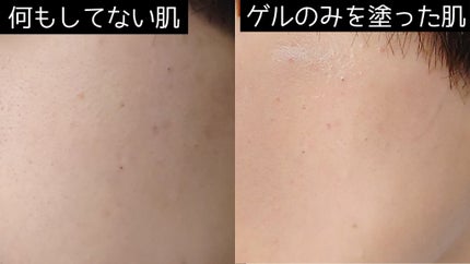 極潤 パーフェクトゲル/肌ラボ/オールインワン化粧品を使ったクチコミ(1枚目)