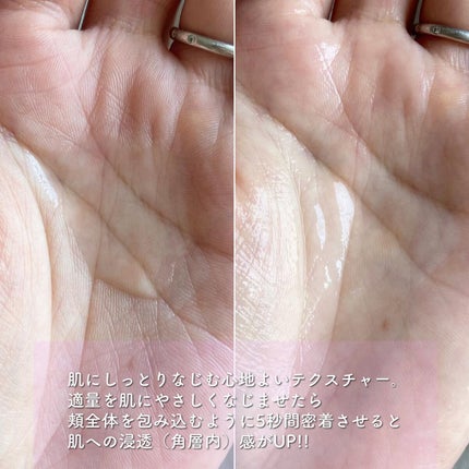 オルビスユー エッセンスローション /オルビス/化粧水を使ったクチコミ(2枚目)