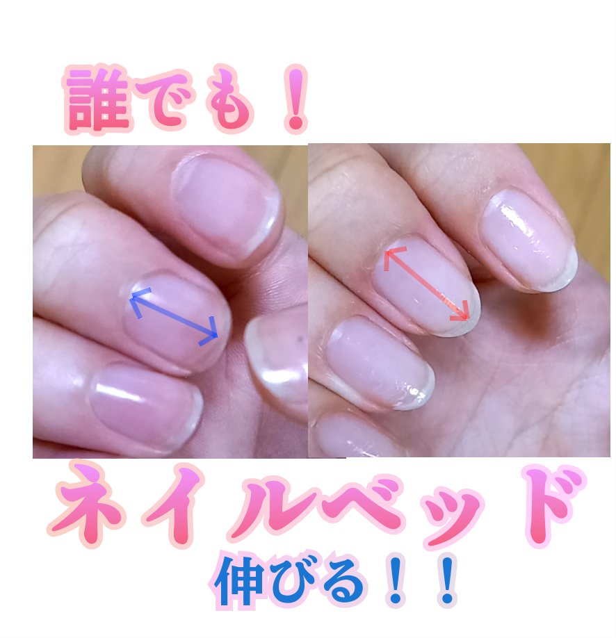 ウィンマックス キューティクルオイル/DAISO/ネイルオイル・トリートメントを使ったクチコミ（1枚目）