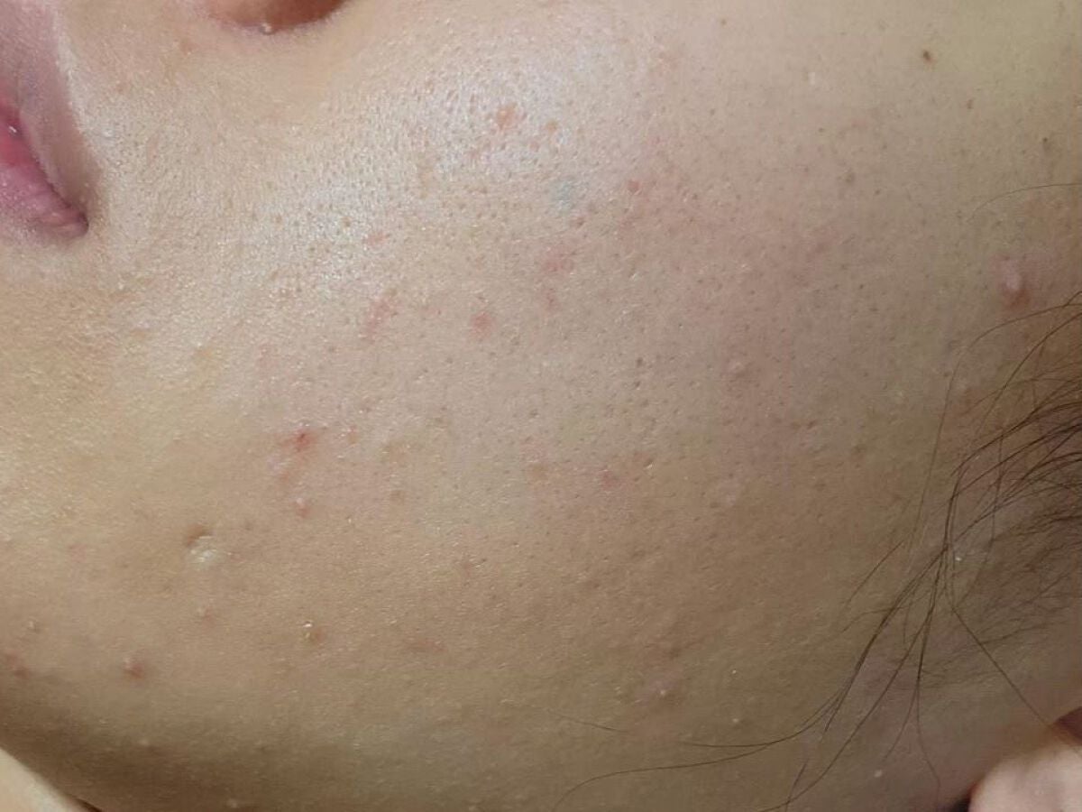 レチノールA 1% アドバンスドリバイタリゼーションクリーム/Life-flo/フェイスクリームを使ったクチコミ(2枚目)