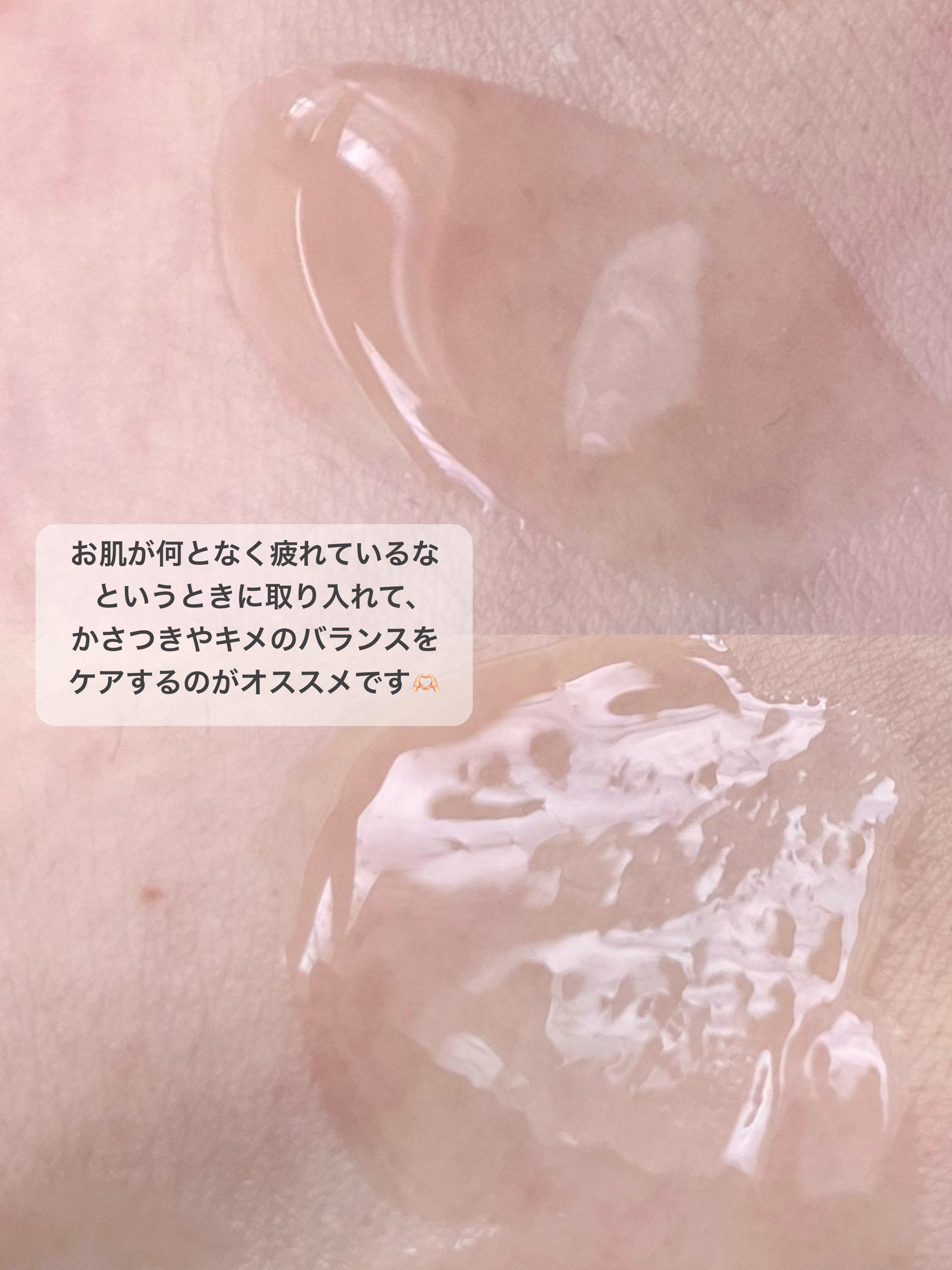 Little Drops Rebirth Day Ampoule/Hersteller/美容液を使ったクチコミ（3枚目）