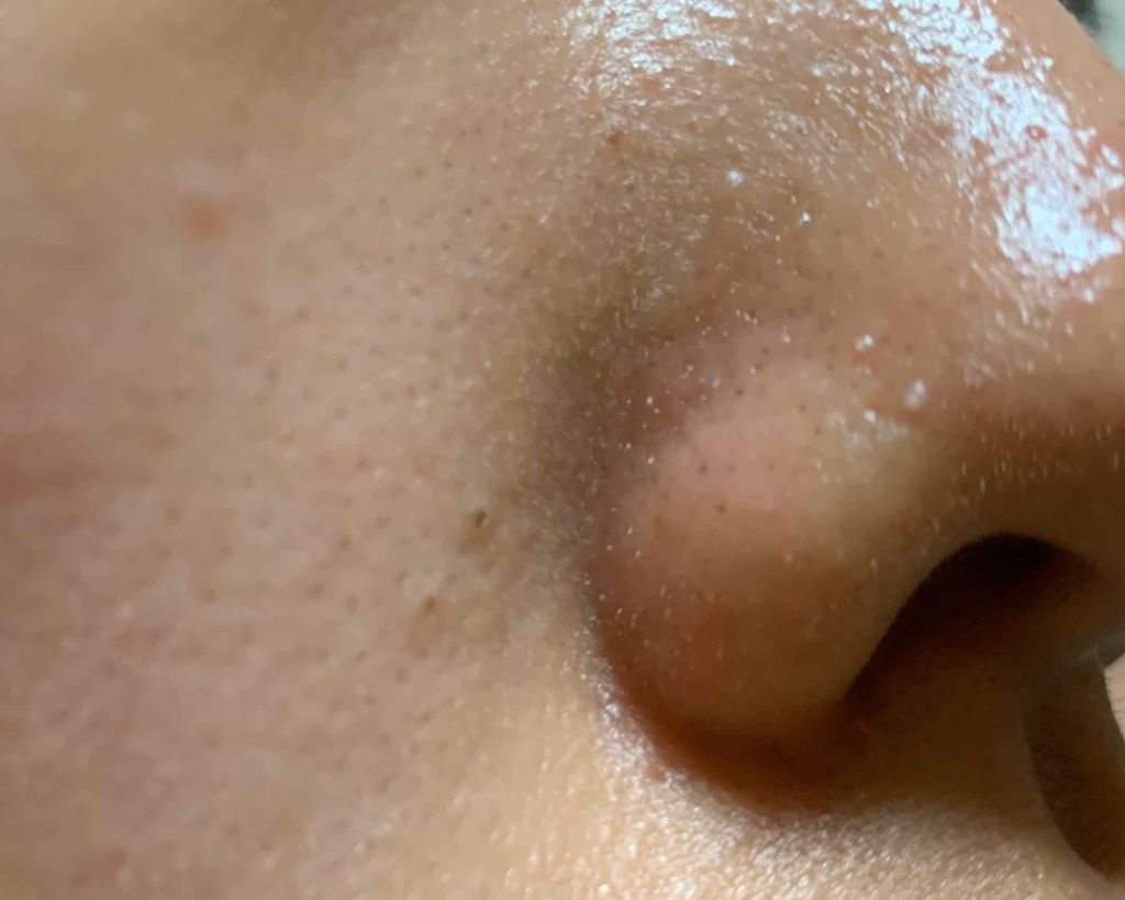 ãã𧺠on LIPS ã質åã§ãðŠãã£ãšæ©ãã§ããŠèª¿ã¹ããããã®ã§ãããæ¹åæ¹æ³ããªã..ãïŒ3æç®ïŒ