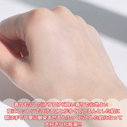 オイデルミン エッセンスローション/SHISEIDO/化粧水を使ったクチコミ(4枚目)
