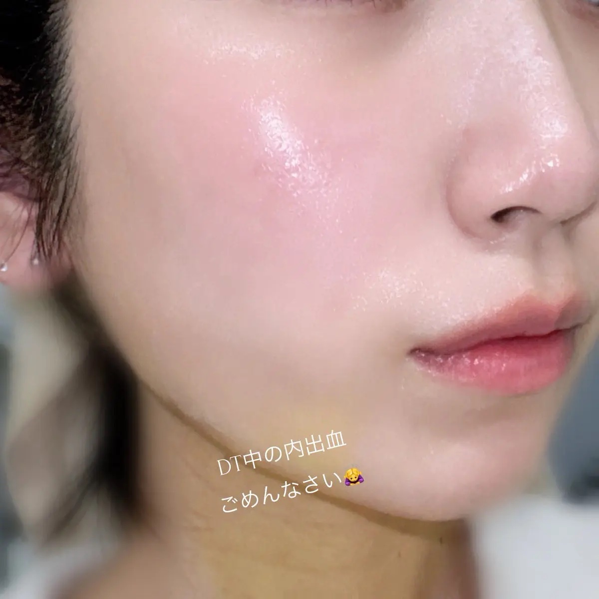 グルカミューントナー/VT/化粧水を使ったクチコミ（3枚目）