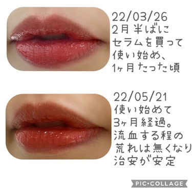 ディオール アディクト リップ マキシマイザー セラム/Dior/リップケア・リップクリームを使ったクチコミ（2枚目）