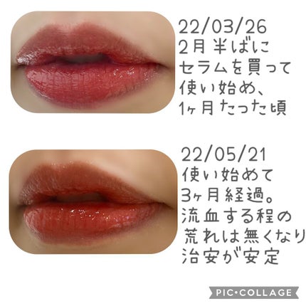ディオール アディクト リップ マキシマイザー セラム/Dior/リップ美容液を使ったクチコミ(2枚目)