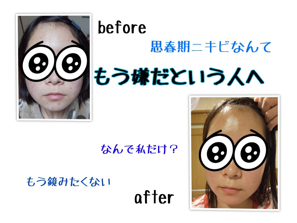 を使ったクチコミ（1枚目）