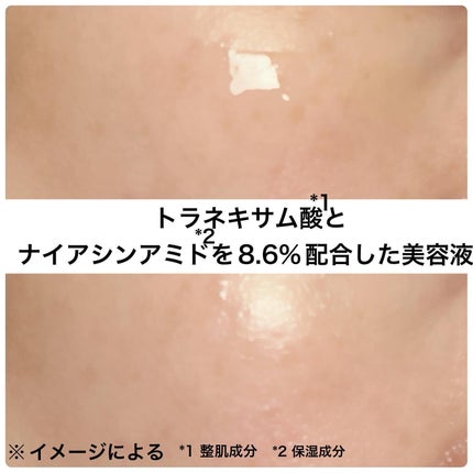 TX-Cream/Dr.Melaxin/フェイスクリームを使ったクチコミ(4枚目)