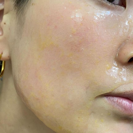 リアルカレンデュラピールオフパック/APRILSKIN/ピーリングを使ったクチコミ(4枚目)