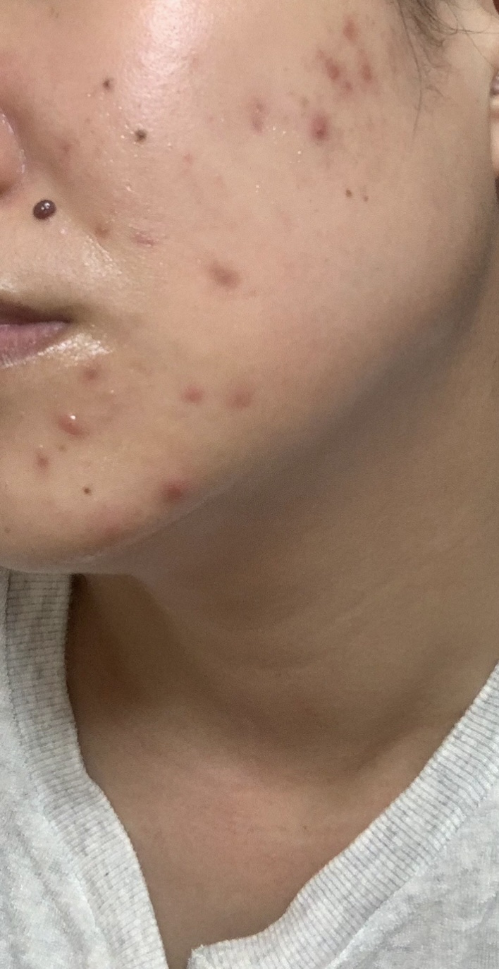 ビタミンミルク/ASUNE /乳液を使ったクチコミ（3枚目）