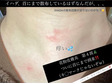 ネイチャーコンク 薬用クリアローション とてもしっとりのクチコミ「　　　　【無限♾️拭き取り化粧水🧴】


　　　　

　　　　　　ズボラ故、朝洗顔は

　　　.....」（3枚目）