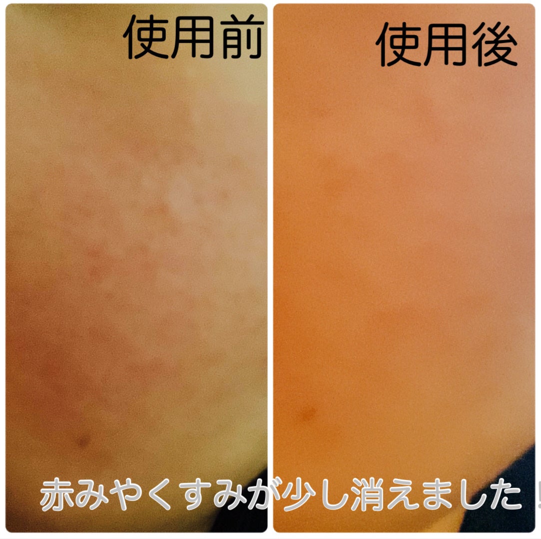 リードルショット300/VT/美容液を使ったクチコミ(8枚目)