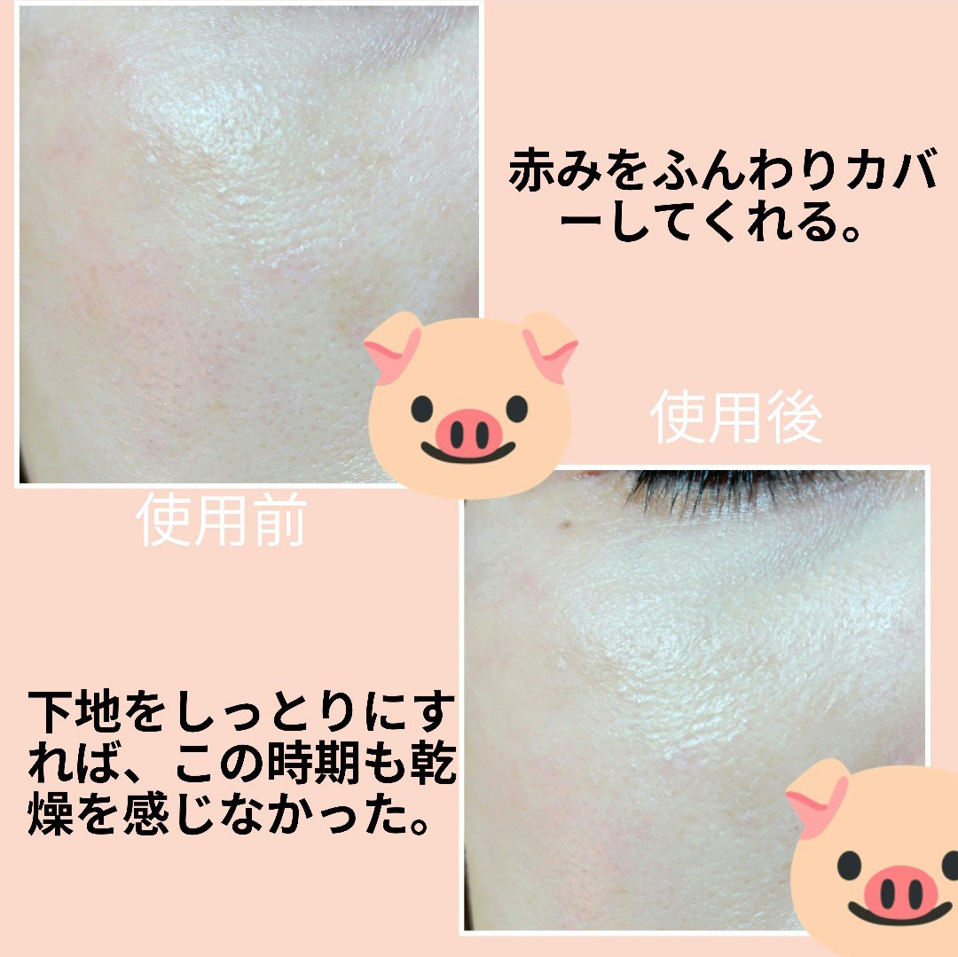 コントロールコンシーラー/MIRIMU/コンシーラーを使ったクチコミ（3枚目）