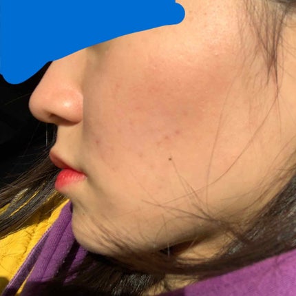 ハトムギ化粧水(ナチュリエ スキンコンディショナー R )/ナチュリエ/化粧水を使ったクチコミ(1枚目)