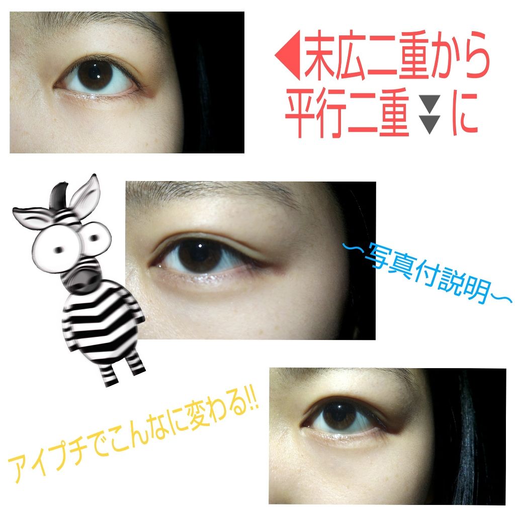 湘南美容アイリッドテープ両面/湘南美容/二重まぶた用アイテムを使ったクチコミ（1枚目）