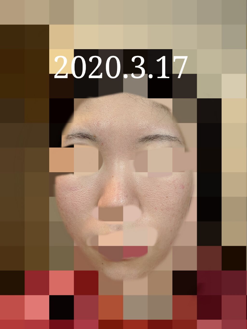 エバレッシュホワイトEXⅡ(医薬品)/matsukiyo/その他を使ったクチコミ（1枚目）