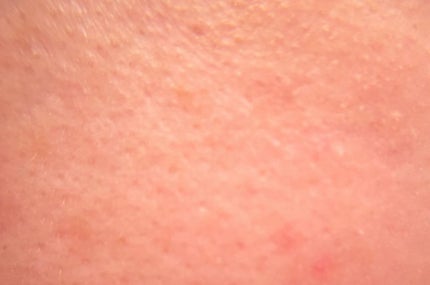 リードルショット100/VT/美容液を使ったクチコミ(3枚目)