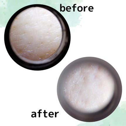 リードルショット300/VT/美容液を使ったクチコミ(5枚目)