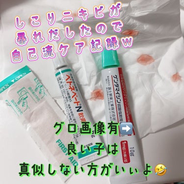 ベトネベートN軟膏AS(医薬品)/第一三共ヘルスケア/その他を使ったクチコミ（1枚目）