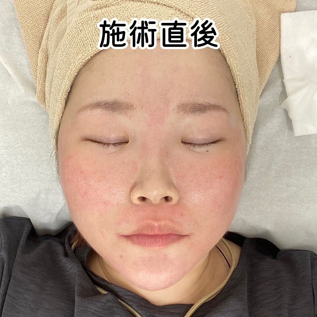 ããã¿ðãã©ãã100 on LIPS ãæ°å®¿é§
ããåŸæ©3åãããã®å Žæã«ããã¢ã€ã·ãŒã¯ãªããã¯æ°å®¿é¢ã«..ãïŒ5æç®ïŒ