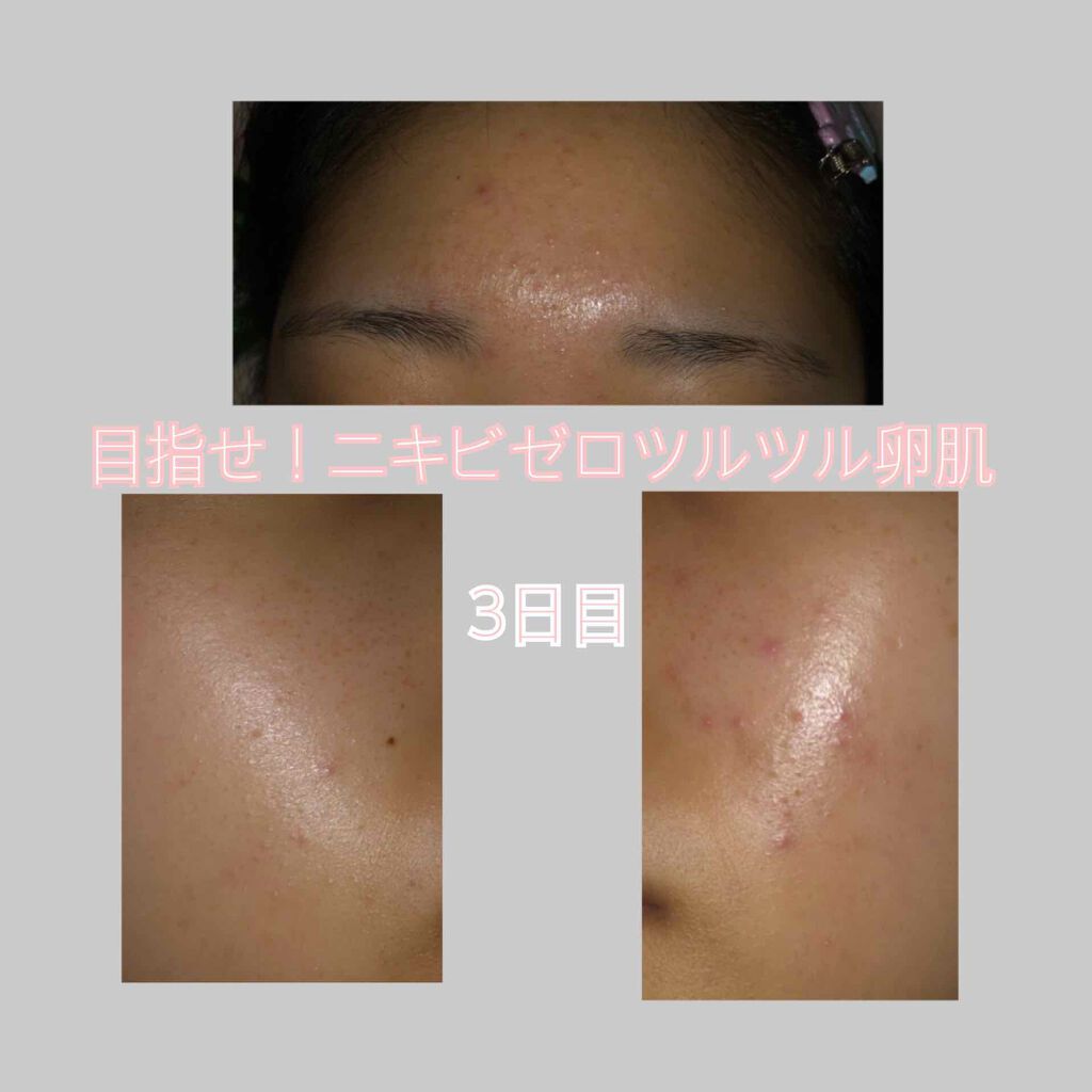 ウォッシャブル コールド クリーム/ちふれ/クレンジングクリームを使ったクチコミ(1枚目)