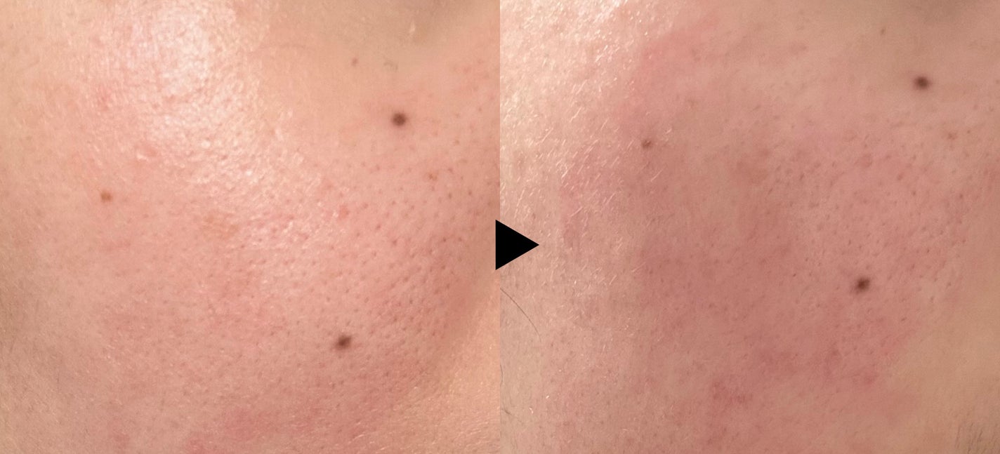 CICA デイリースージングマスク/VT/シートマスク・パックを使ったクチコミ(5枚目)